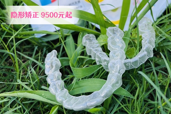 全隐形矫正