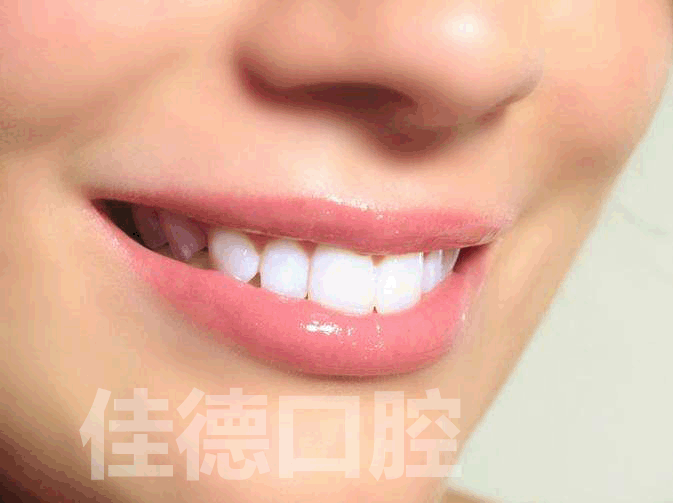 合肥龋坏怎么治疗好